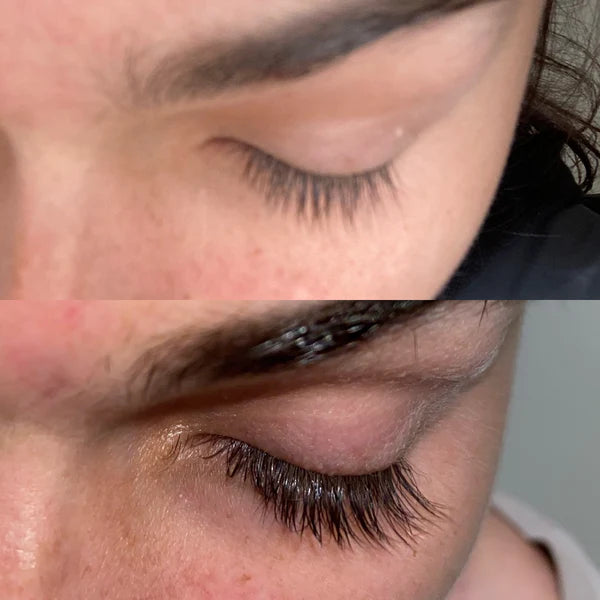 Blakstienų augimą skatinantis serumas